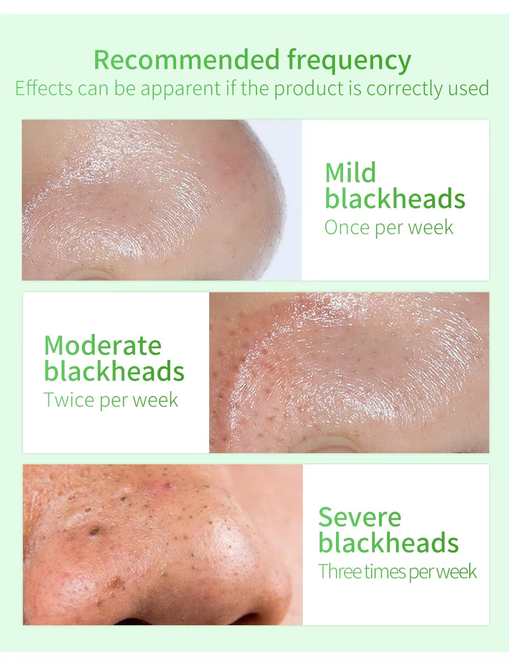 LANBENA Blackhead & Pores Serum